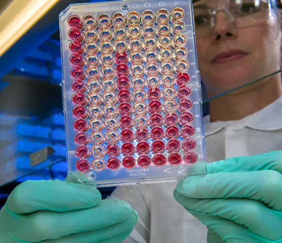 women holding blood samples in gloved hand